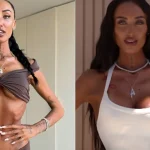 Operația periculoasă pentru talia de viespe, noul trend al influencerițelor